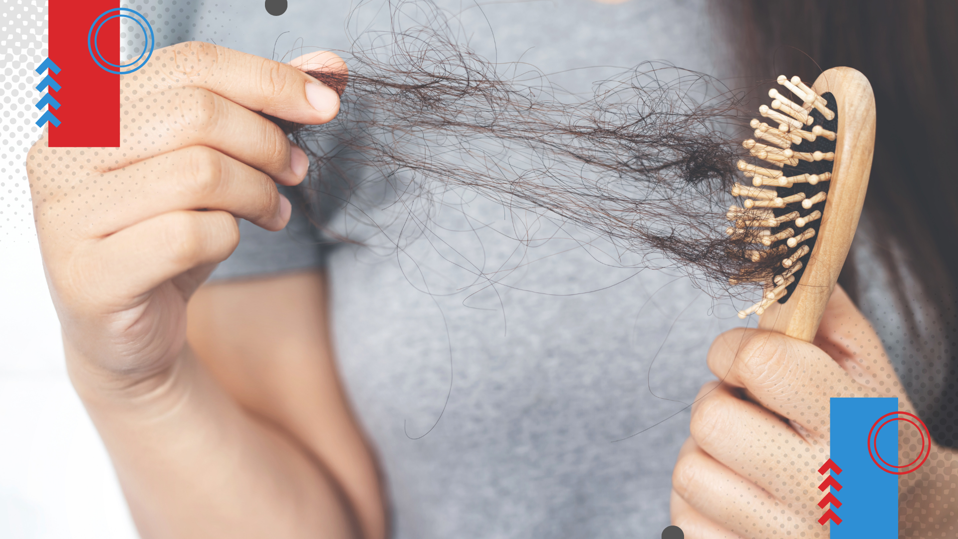 Queda de cabelo: quais exames investigam a causa (e o que eles não mostram)